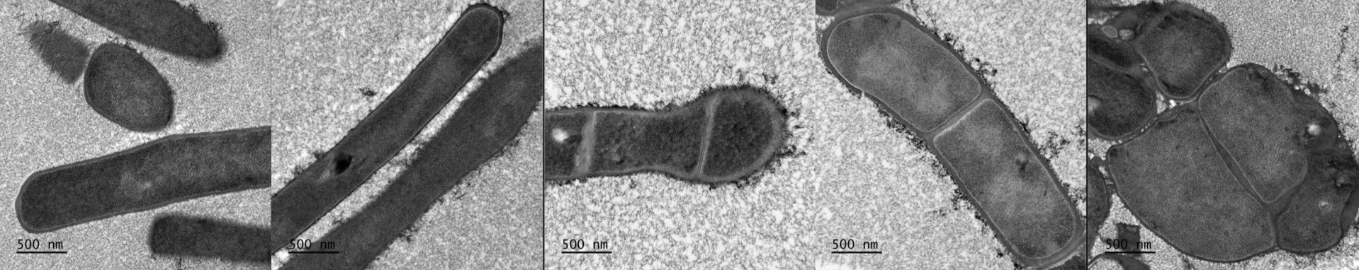 Transmission electron microscopy of Bacillus subtilis cells